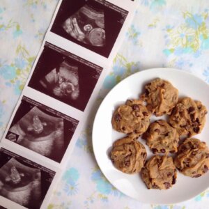 ultrasound pictures and cookies